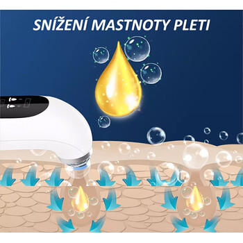 Poremax Oxygen - Kozmetický prístroj na čistenie pleti
